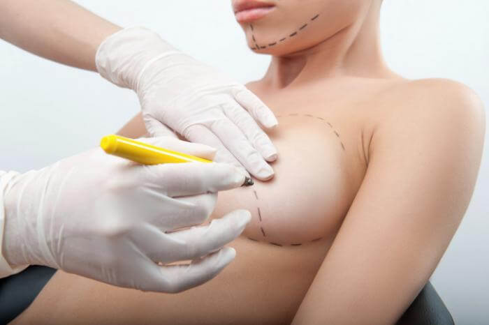 chirurgia plastica al seno